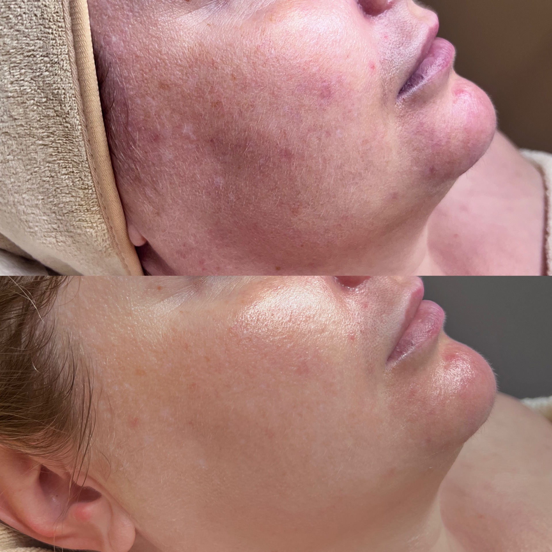 Shine & Glow - kasvohoito